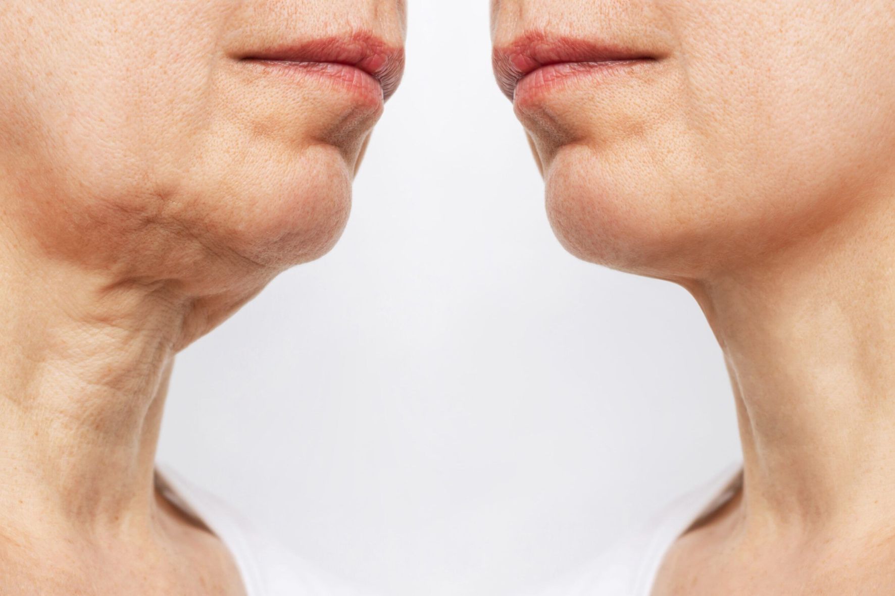 Facial Aesthetics in Bangor