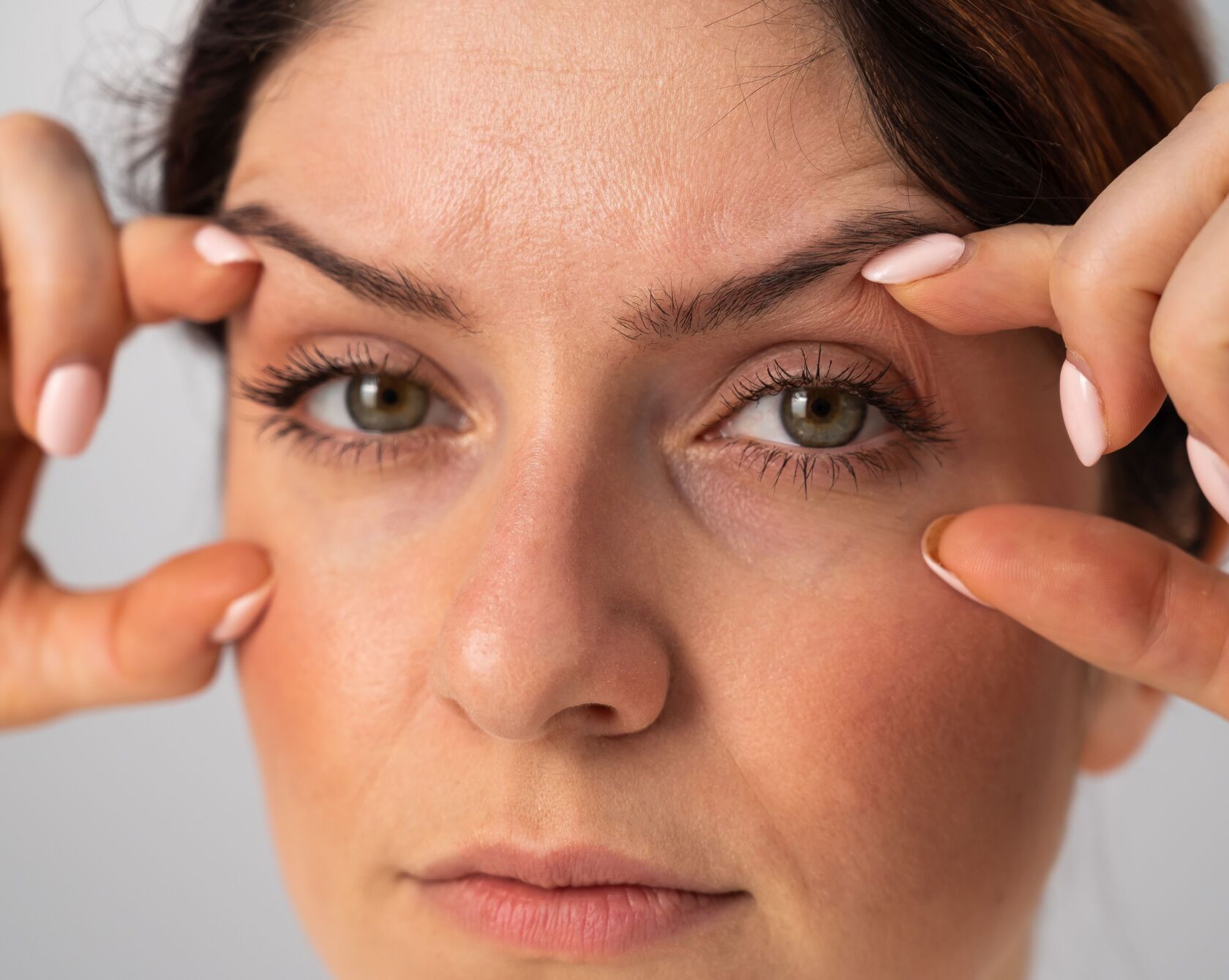 hyperpigmentation treatment Belfast