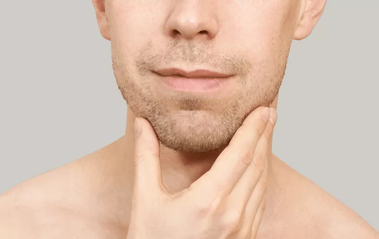 hyperpigmentation treatment Belfast