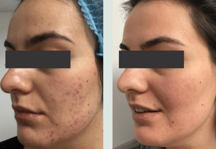 Facial Aesthetics in Belfast