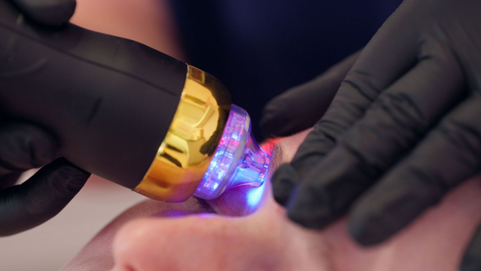 Facial Aesthetics in Belfast